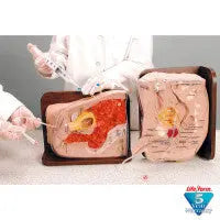 Cath-Ed I And Catch-Ed II - LF01029U - First Aid Market